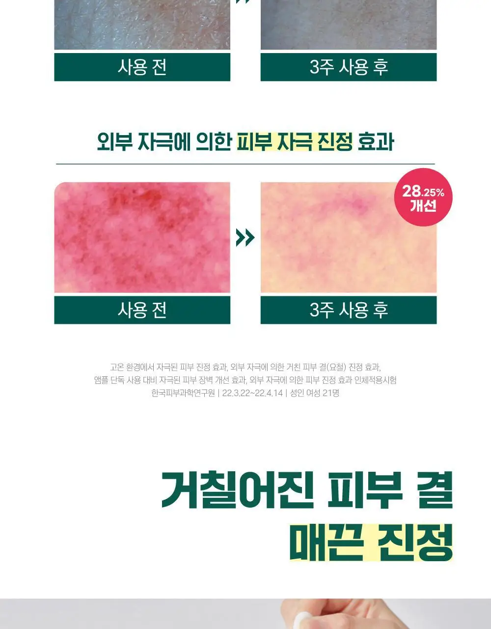 [집중진정] 라운드랩 소나무 진정 시카 앰플 30ml 기획 (+토너 20ml) 상세페이지 21